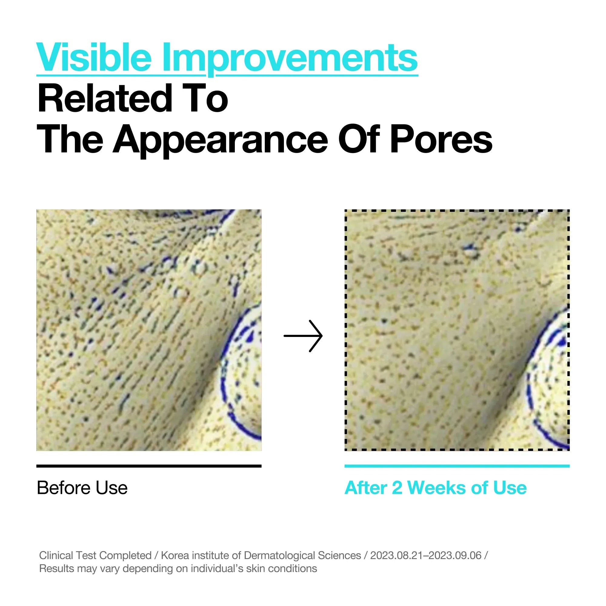 Anua BHA Gentle Exfoliating Toner (150ml)