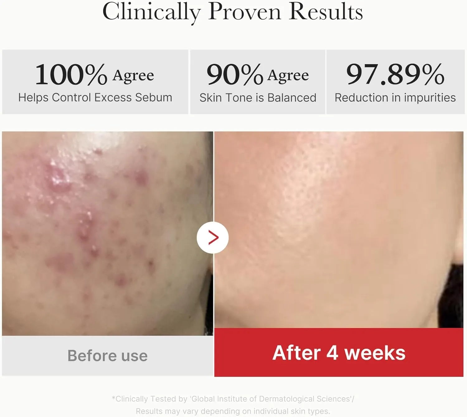 Red Succinic Acid Panthenol Pads